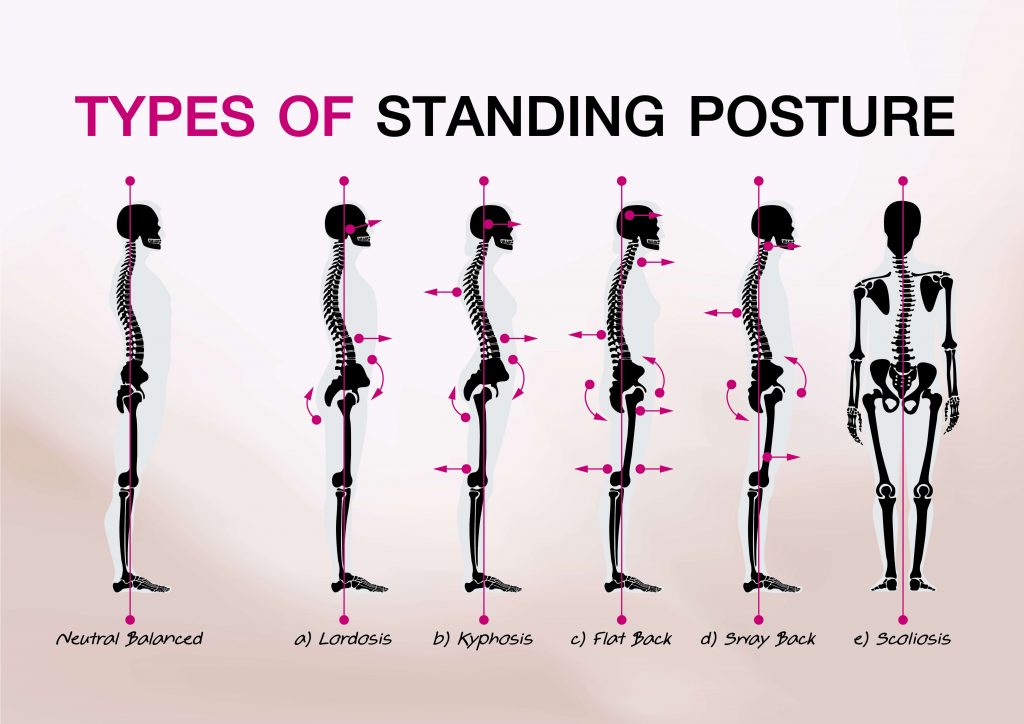 posture types